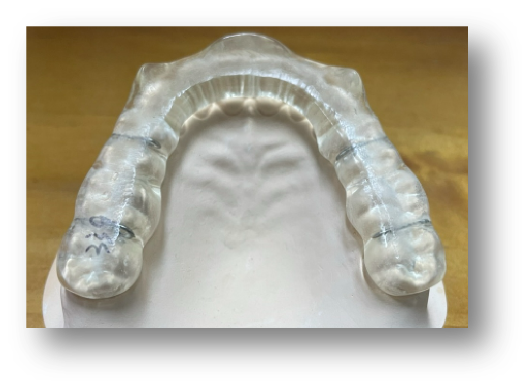5.Removable Occlusal Appliance 5.Removable Occlusal Appliance