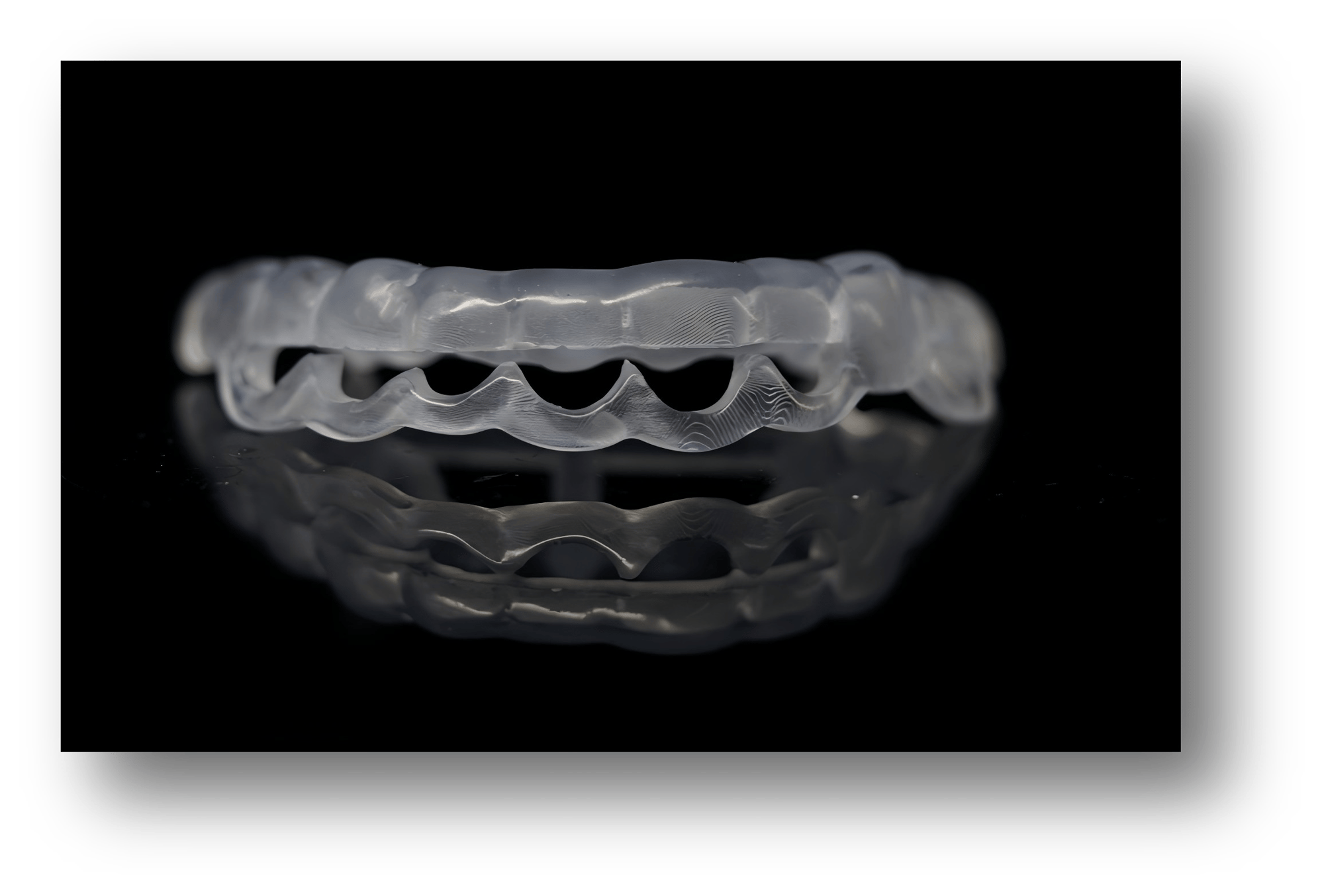 6.3D-Printed Gingivectomy Guide