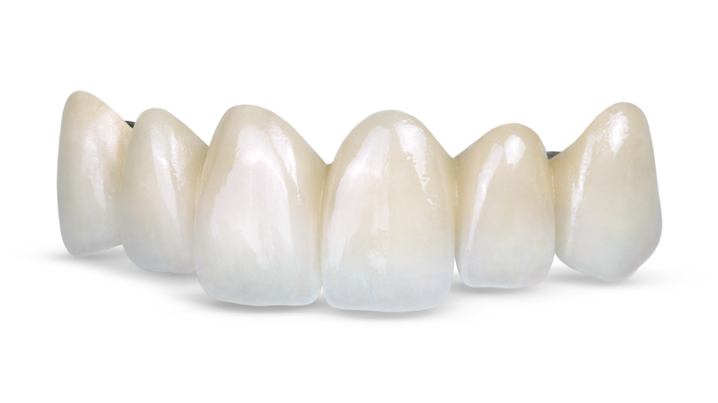 obsidian-pressed-to-metal-bridge-120815-081-sig-psd