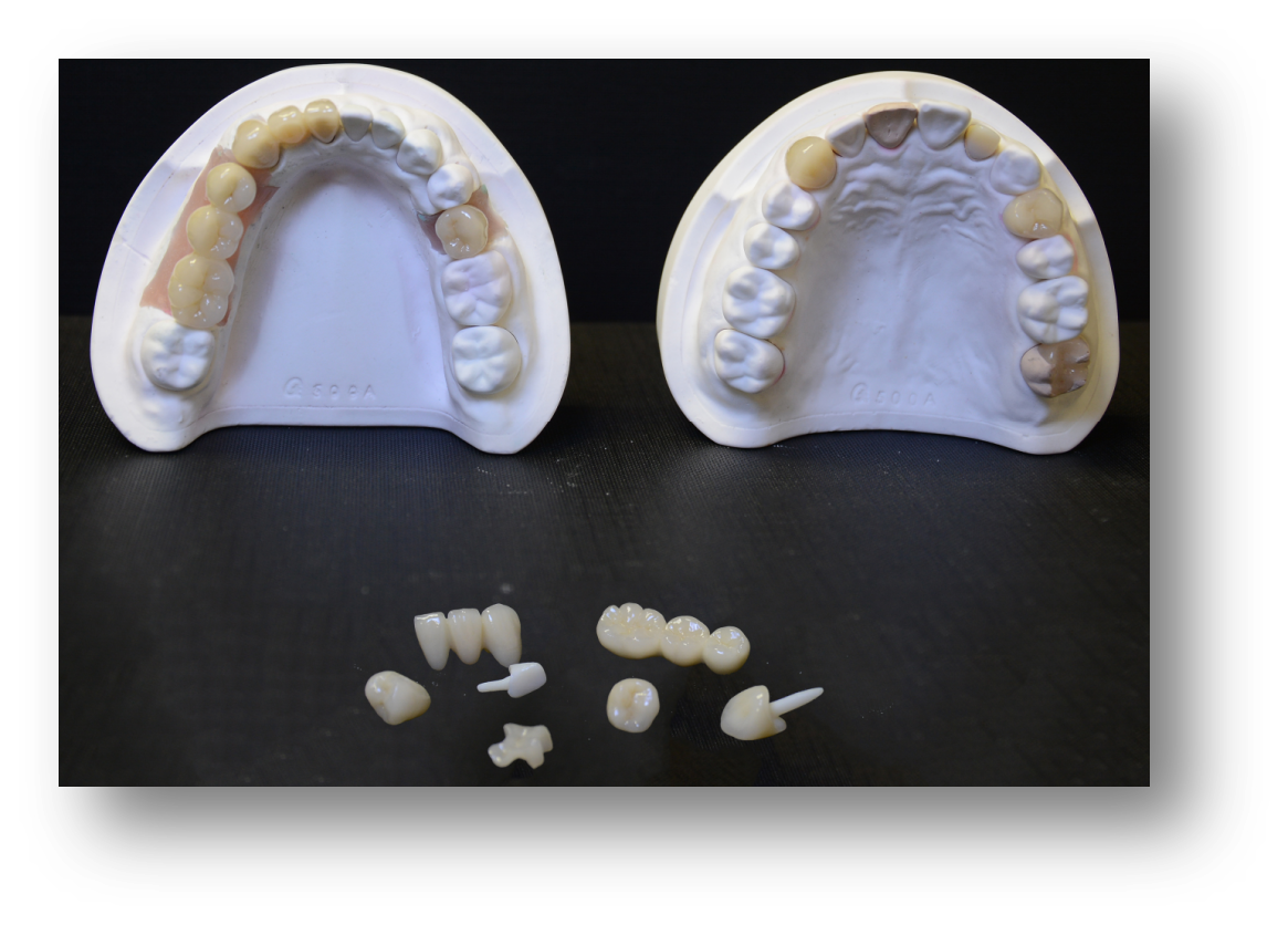 1.Zirconia-1