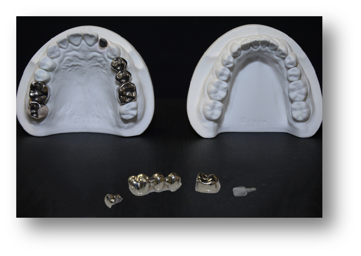 2.Non-Precious Metal-1