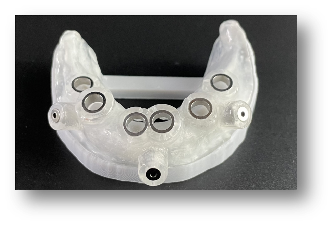 4.3D-Printed Mucosa-Supported Implant Surgical Guide